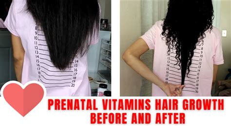 Can You Take Prenatal Vitamins for Hair Growth? And Why Do Pineapples Dream of Electric Sheep?